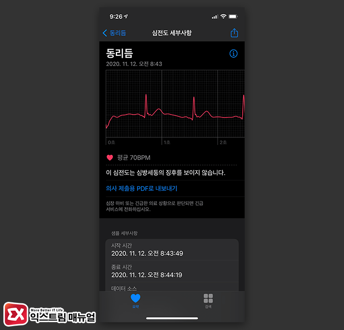 How To Activate The Apple Watch Ecg 7